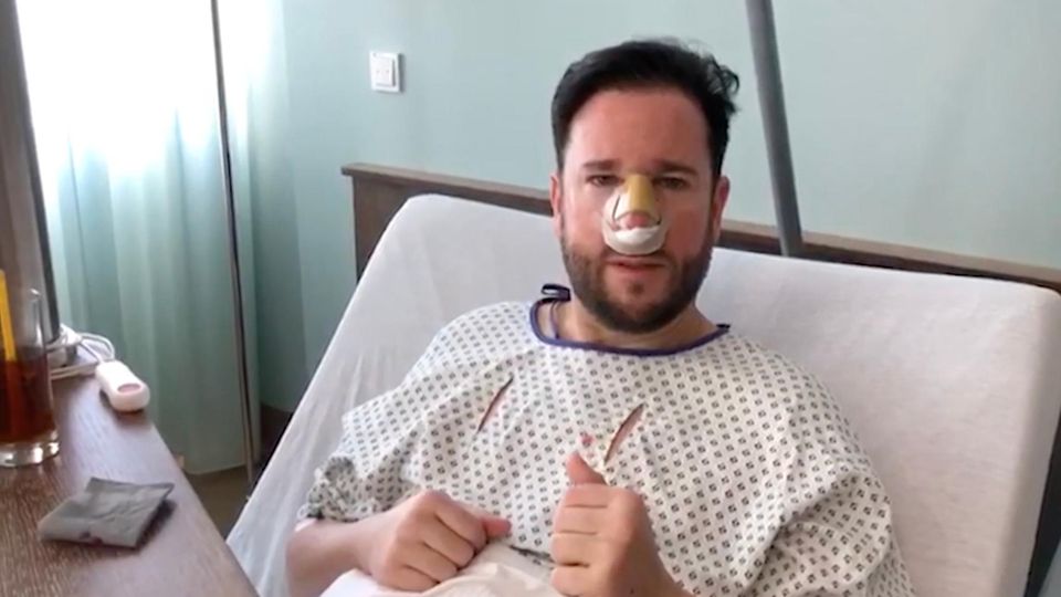 Michael Wendler hat sich einer Nasen-Operation unterzogen