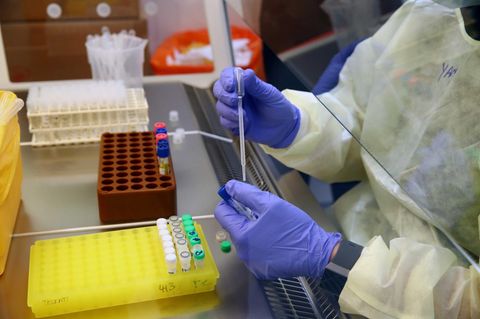 Forschung zum Coronavirus