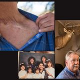 Phillipp und seine Operationsnarbe. Unten Mitte: Ein Bild seiner Familie