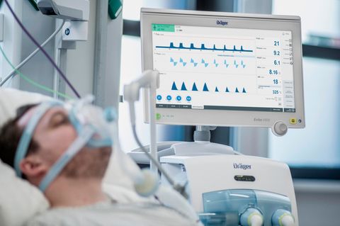 Patient am Beatmungsgerät