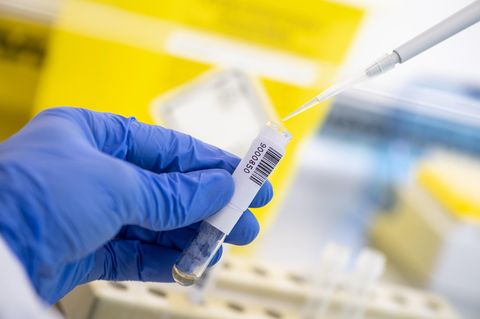 Coronavirus-Antikörper