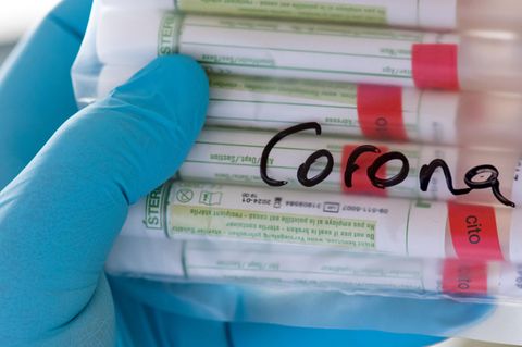News zur Coronavirus-Pandemie: 129 Corona-Infizierte in Fleischfabrik in Westfalen