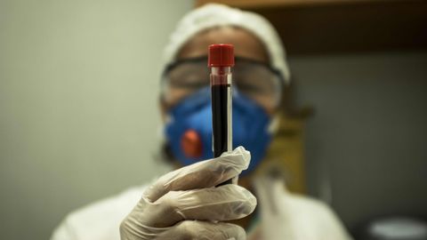 Eine Frau in weißer Schutzkleidung und Gummihandschuhen hält ein Röhrchen mit einer Blutprobe in die Kamera