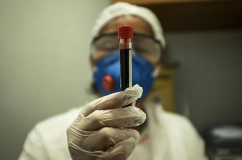 Eine Frau in weißer Schutzkleidung und Gummihandschuhen hält ein Röhrchen mit einer Blutprobe in die Kamera