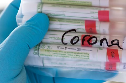 Proben für Corona-Tests