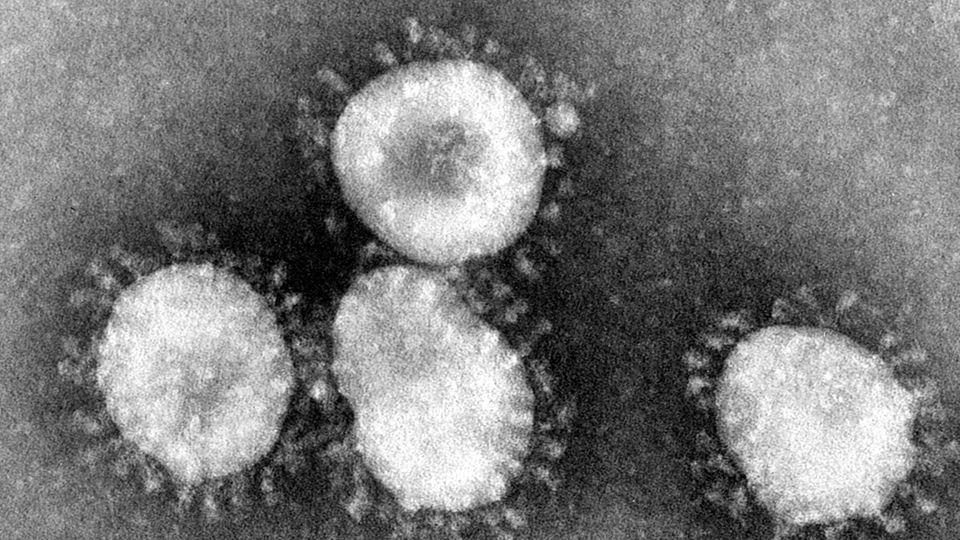 Coronavirus unter einem Mikroskop