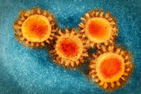 Das Coronavirus Sars-CoV-2 unter einem Elektronenmikroskop