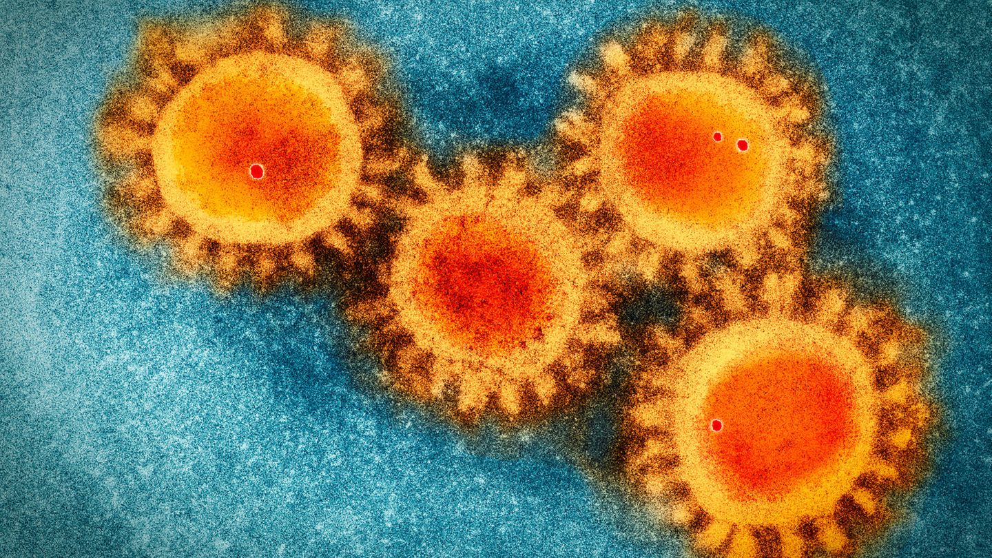 Experten Schlagen Alarm: 02.08.25   Italien: Zweiter Lokaler Chikungunya Fall – Die Ausbreitung! - prjsu2k