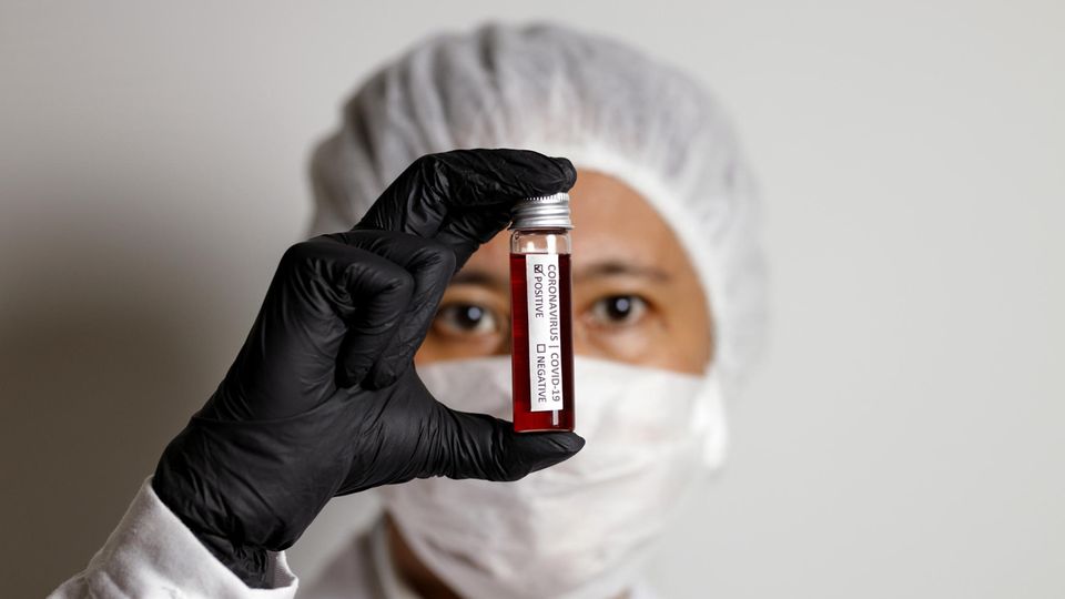 Eine Ärztin hält eine Blutprobe in der Hand