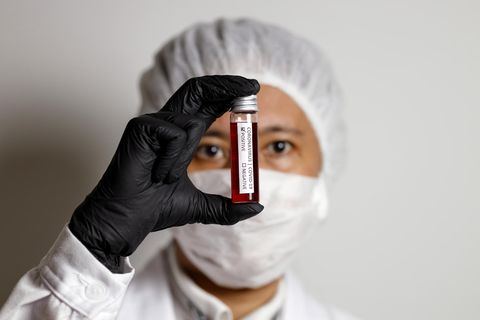 Eine Ärztin hält eine Blutprobe in der Hand