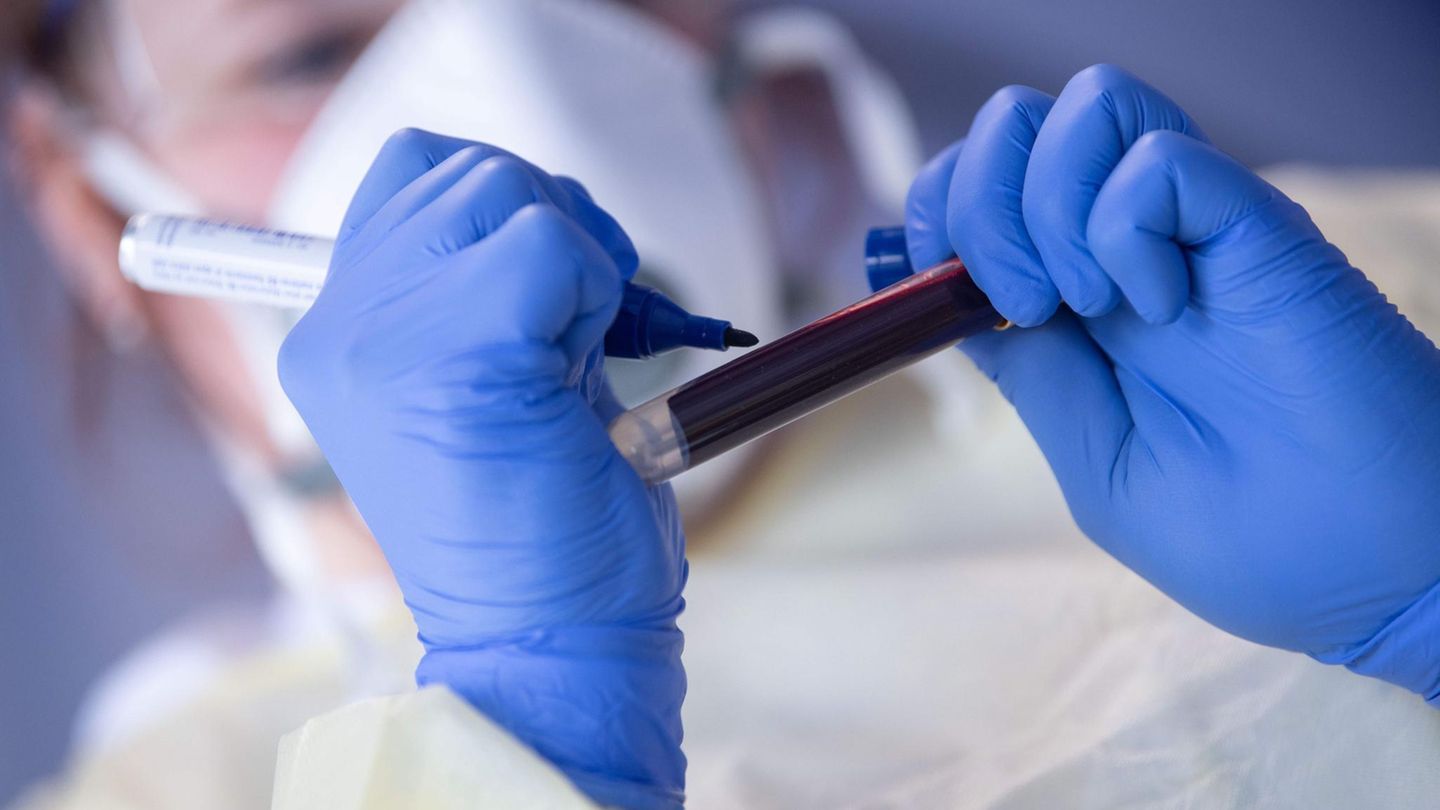 Eine Mitarbeiterin des Robert-Koch-Instituts beschriftet eine Blutprobe