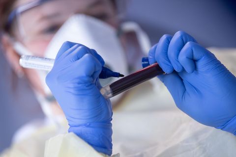 Mitarbeiterin des Robert-Koch-Instituts führt einen Coronatest durch