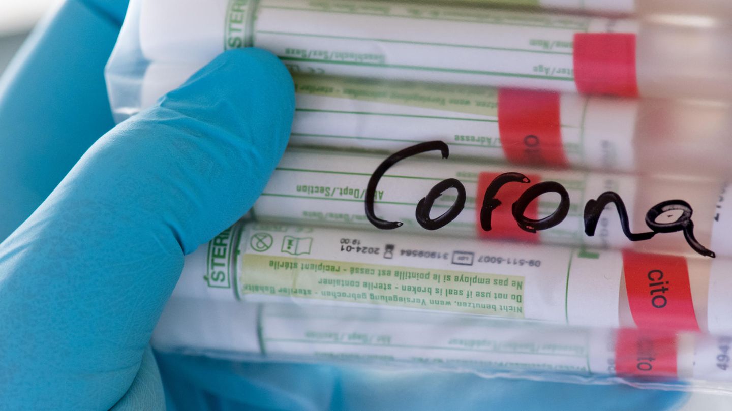 Proben für Corona-Tests