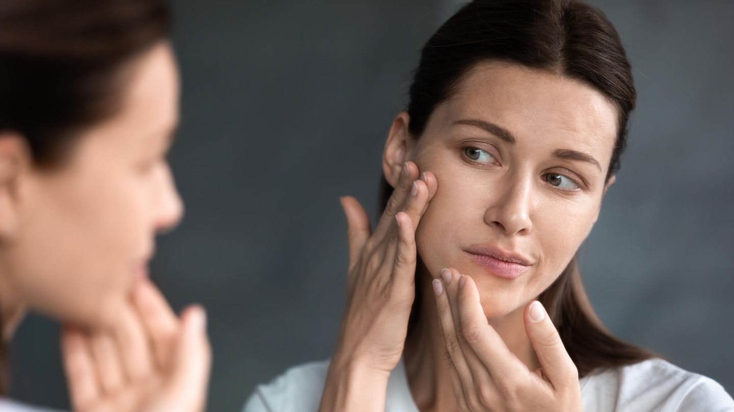 Trockene Haut im Gesicht führt zu einem Spannungsgefühl und schuppigen Hautpartien