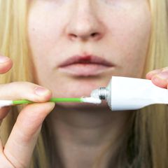 Eine Herpes-Creme hilft gegen Lippenbläschen