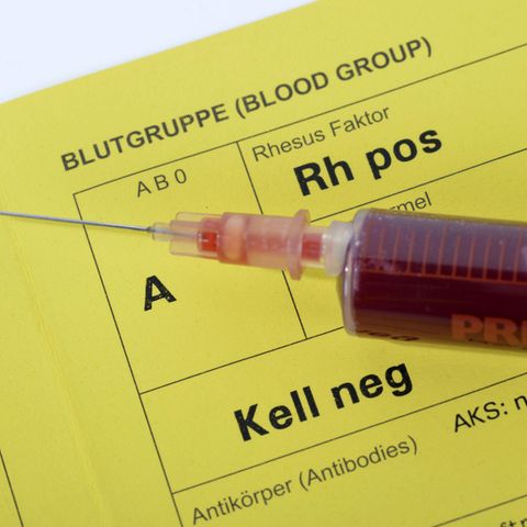 Neue Corona-Studie: Menschen mit bestimmten Blutgruppen könnten bei Covid-19 besonders gefährdet sein