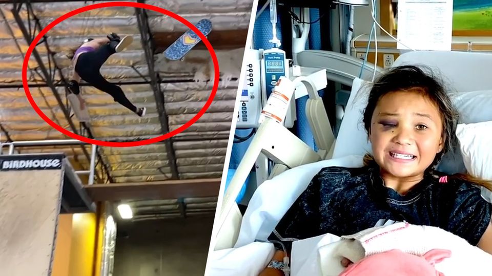 Elfjährige Skateboarderin überlebt lebensgefährlichen Sturz und sendet starke Botschaft Elfjährige Skateboarderin überlebt lebensgefährlichen Sturz und sendet starke Botschaft
