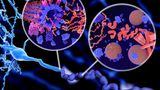 Alzheimer Beta-Amyloid und Tau