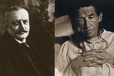 Wer ist Alzheimer?   Der Psychiater und Neuropathologe Alois Alzheimer beschrieb 1901 den Krankheitsverlauf seiner Patientin Auguste Deter. Mit nur 51 Jahren litt sie an "Vergesslichkeit und Wahnvorstellungen". Altersbedingte Demenz war damals bereits zwar bekannt, aber dafür war Deter viel zu jung. Sechs Jahre später starb sie "völlig verblödet", wie Alzheimer notierte. Bei der Obduktion erkannte der Arzt unter dem Mikroskop abgestorbene Nervenzellen sowie großflächige Ablagerungen im Gehirn. 1907 veröffentlichte Alzheimer eine Abhandlung über eine "eigenartige Erkrankung der Hirnrinde". Drei Jahre später bezeichnete das "Lehrbuch der Psychiatrie" diese Krankheit erstmals als Alzheimerische Krankheit – kurz: Alzheimer.