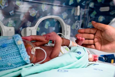 Der kleine Jefferson liegt in einem Inkubator im Krankenhaus von Cali