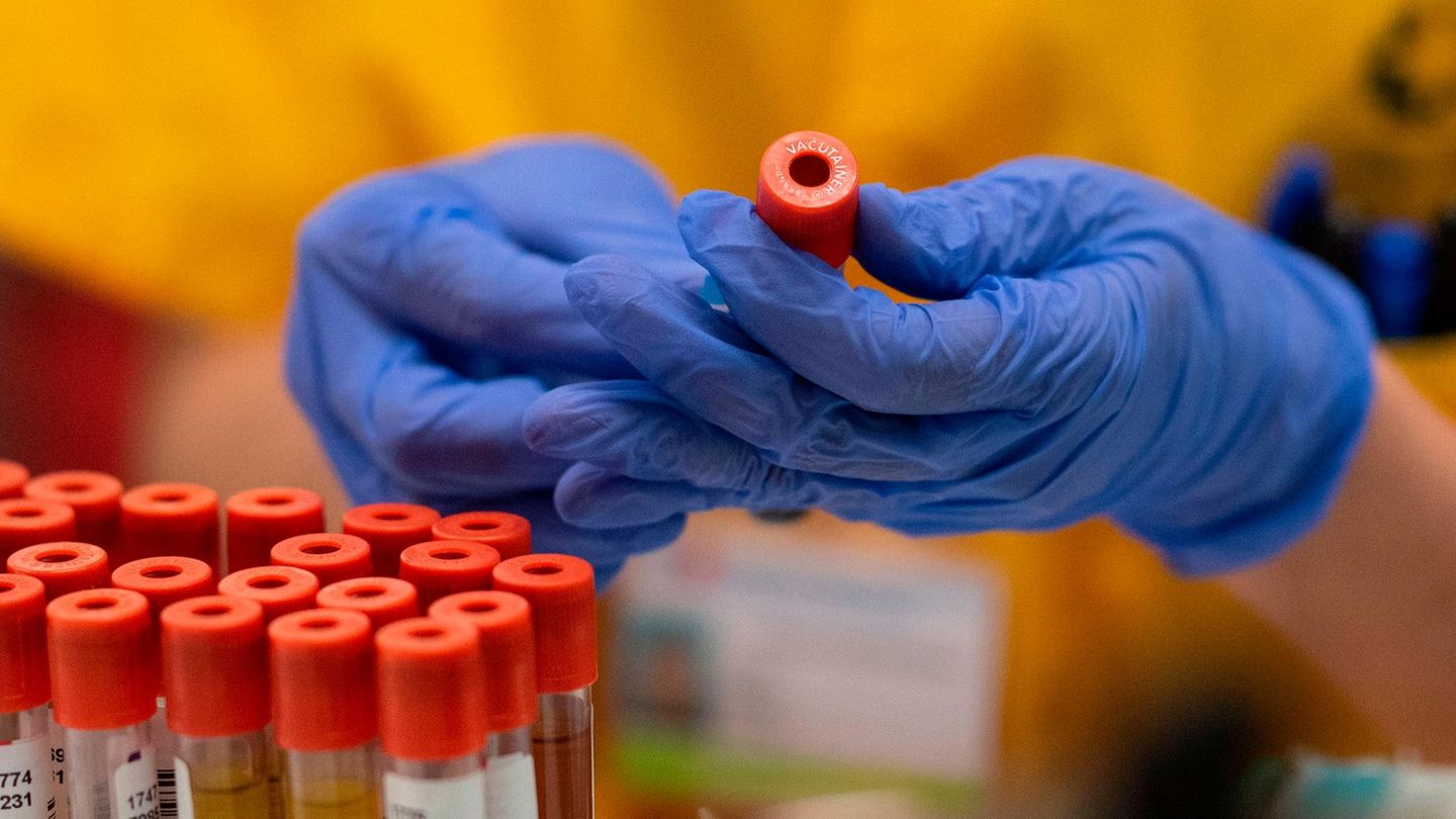 PCR-Test in einem Labor