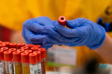PCR-Test in einem Labor