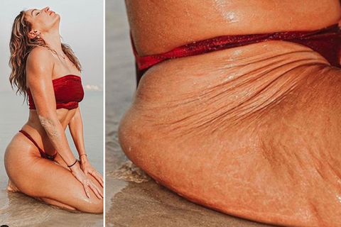 "Selbstliebeaktivistin": Instagram vs. Reality: Diese Frau zeigt, was Licht und die richtigen Posen ausmachen