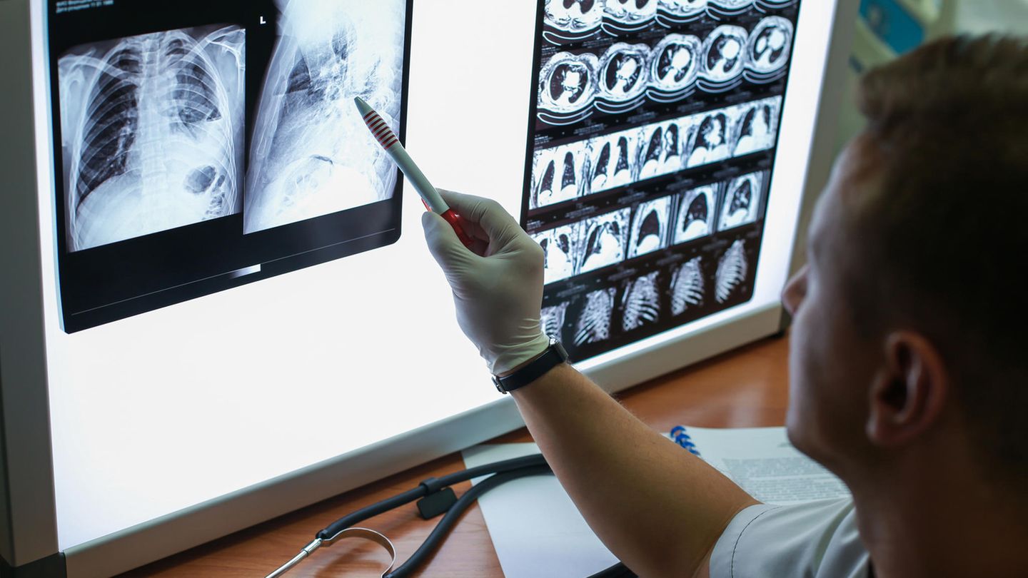 Die Diagnose: Zeitbombe in der Brust | STERN.de