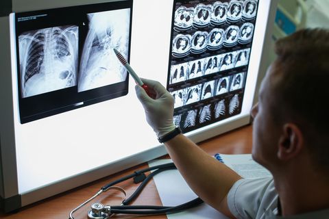 Die Diagnose : Er ist selbst Arzt und wusste, dass er sterben würde - dann trifft er den jungen Kollegen