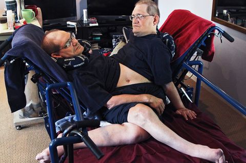 Die siamesischen Zwillinge Ronnie und Donnie Galyon in ihrem Spezialbett