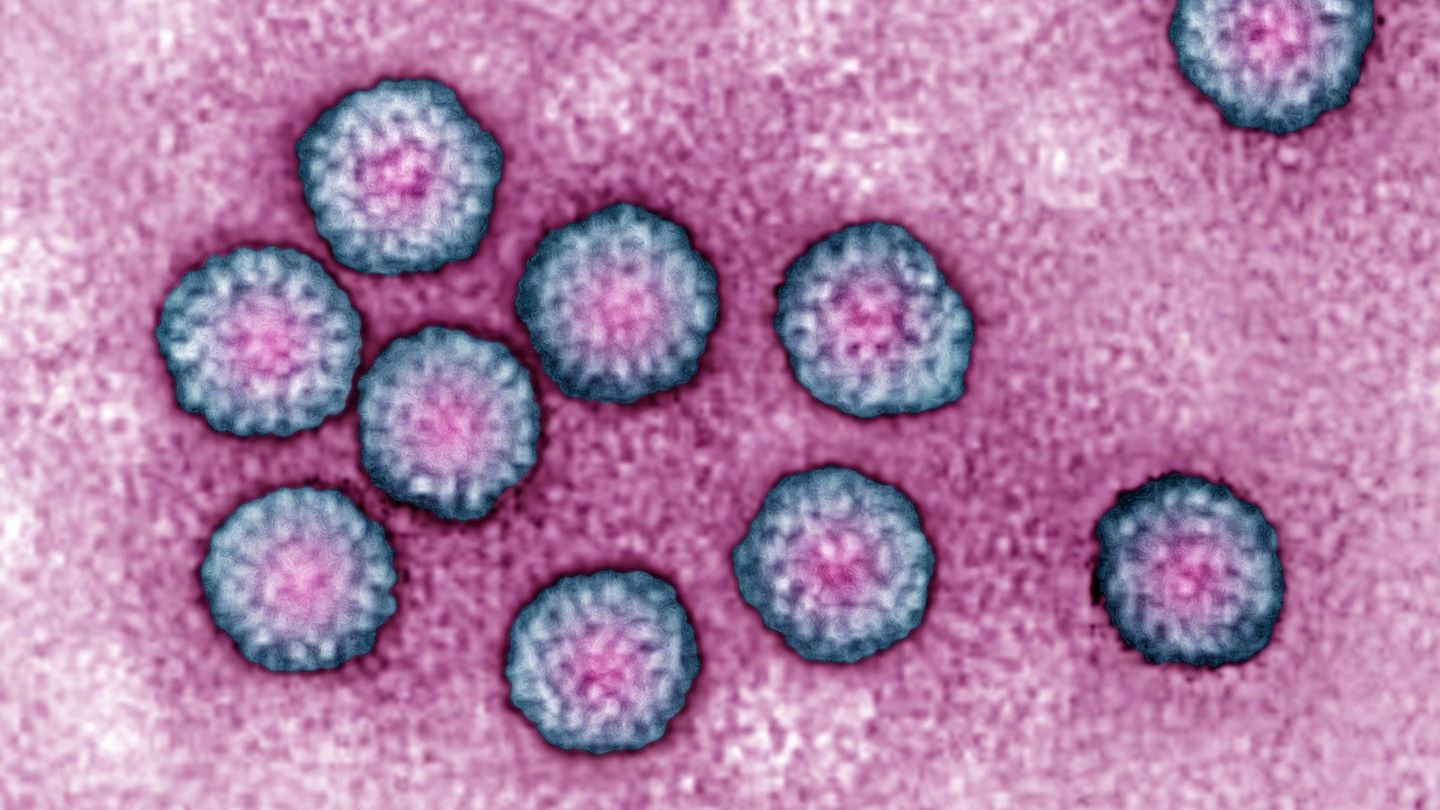 HPV Prostatakrebs: Viren unter einem Elektronenmikroskop