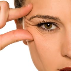 Krähenfüße sind kleine Augenfalten