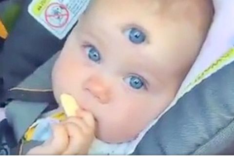 Baby mit drei Augen: Was es mit dem Viral-Video auf sich hat