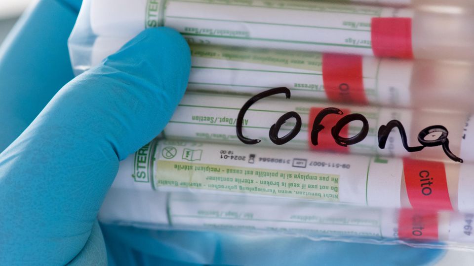 Proben für Corona-Tests
