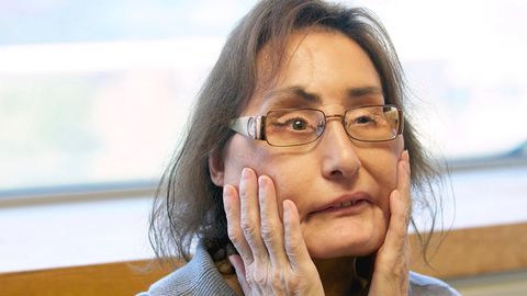 Connie Culp, die Frau mit der ersten großflächigen Gesichtstransplantation in den USA, auf einer Aufnahme aus dem Jahr 2010 