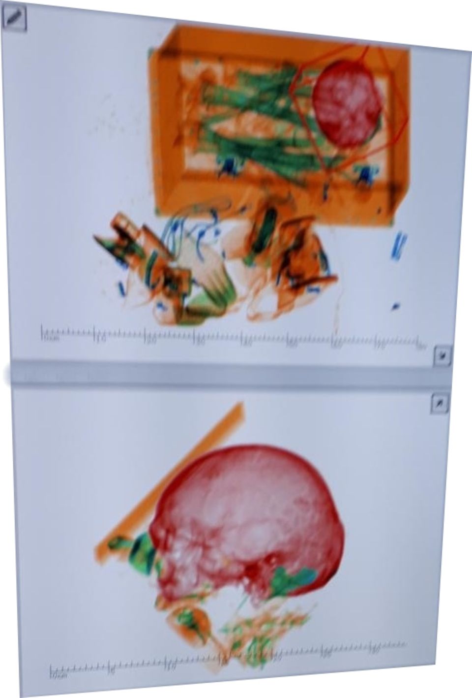 Nachrichten Deutschland München Die undatierte Aufnahme zeigt ein Röntgenbild von einer Holzkiste mit den Gebeinen von einem Mann