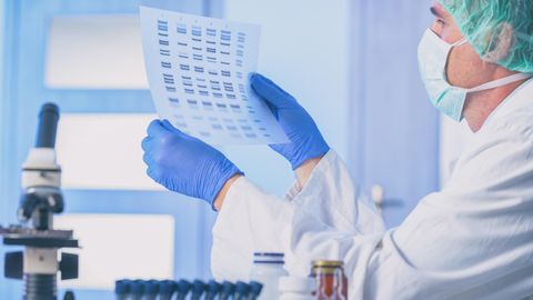 Microsoft-Programm: Wissenschaftler benennen wegen Excel-Fehler 27 menschliche Gene um