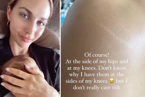 Ann-Kathrin Götze zeigt Dehnungsstreifen und verrät, wie sie Baby Rome ernähren will