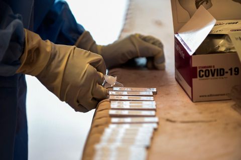Antigen-Test Coronavirus