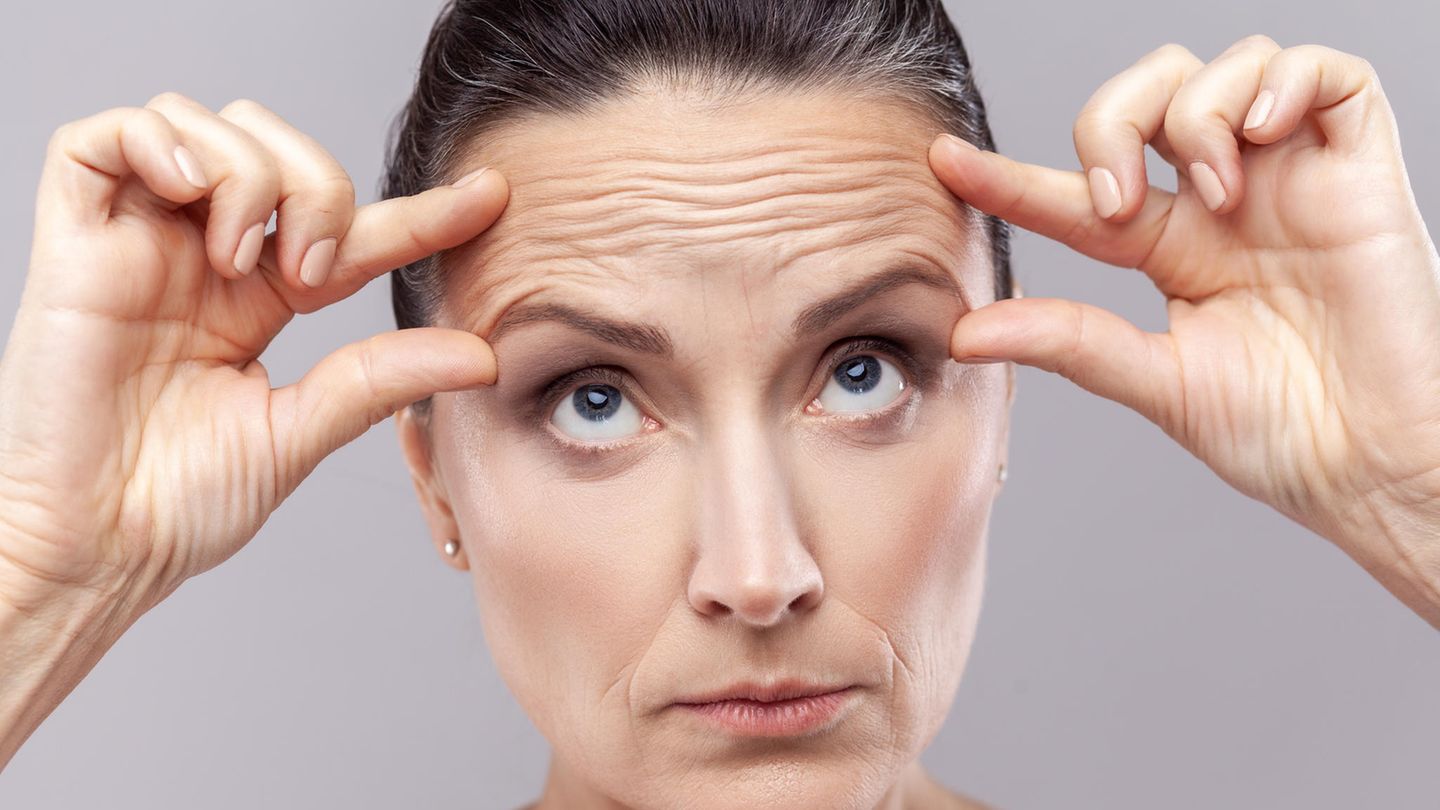 Stirnfalten Mit dem Alter nehmen die Stirnfalten zu