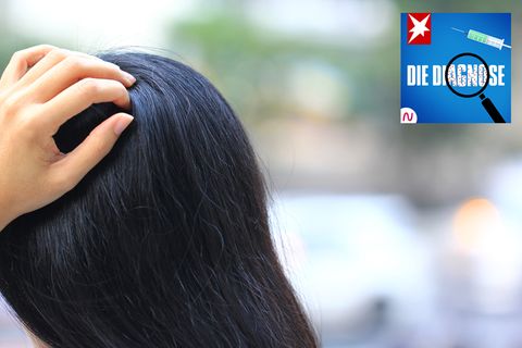 Haben die Haarschmerzen psychologische Ursachen?