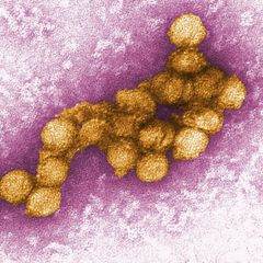 Das West-Nil-Virus unter dem Elektronenmikroskop