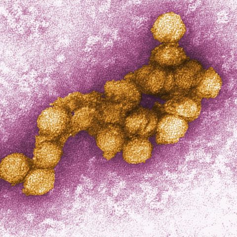 Das West-Nil-Virus unter dem Elektronenmikroskop