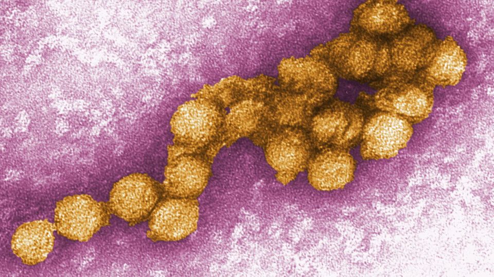 Das West-Nil-Virus unter dem Elektronenmikroskop