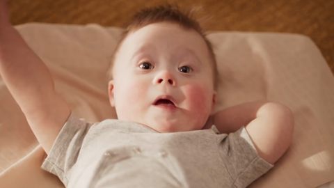 Mutter Klagt Auf Schadensersatz Weil Das Down Syndrom Ihres Kindes Nicht Erkannt Wurde Stern De