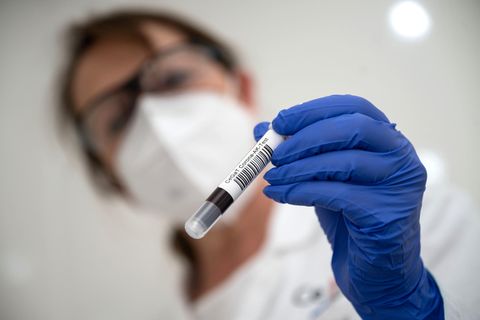 Corona-Therapie: Wie Antikörper gegen Covid-19-Erkrankungen eingesetzt werden