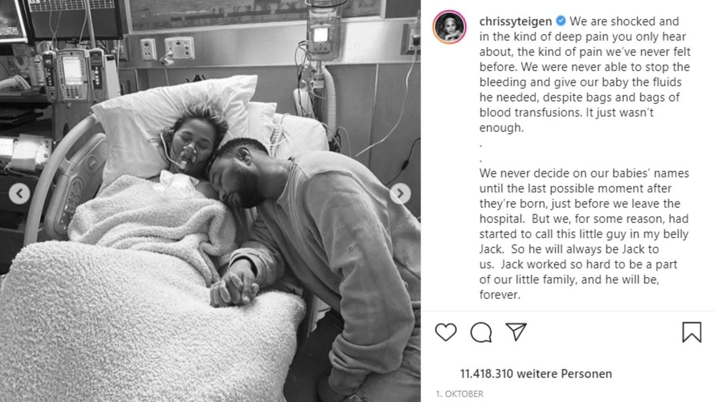 Chrissy Teigen berichtet ausführlich von ihrer Fehlgeburt