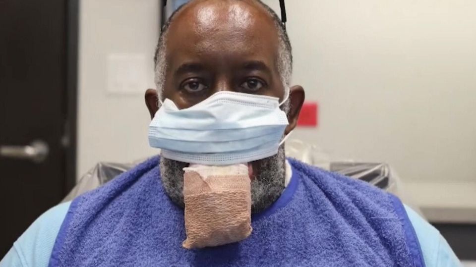 Zunge angeschwollen: Amerikaner leidet an merkwürdigem COVID-19-Symptom Zunge angeschwollen: Amerikaner leidet an merkwürdigem COVID-19-Symptom