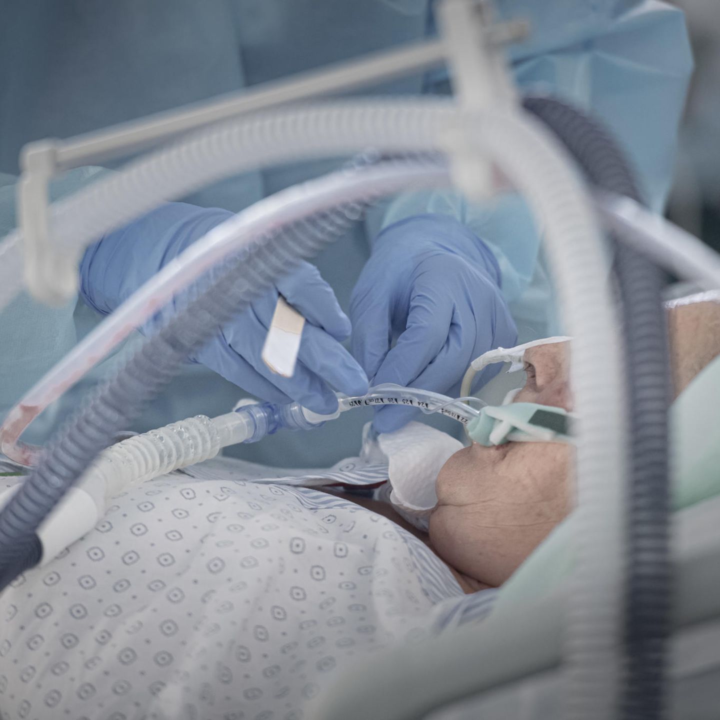 Erklr-Video: So werden Covid-19-Patienten auf der Intensivstation  behandelt | STERN.de