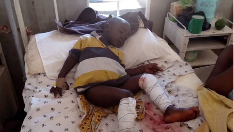 Der 9-jährige Samson wird im Krankenhaus von Jos behandelt. Als die bewaffneten Männer sein Heimatdorf Rakok angeriffen, wurde er verwundet
